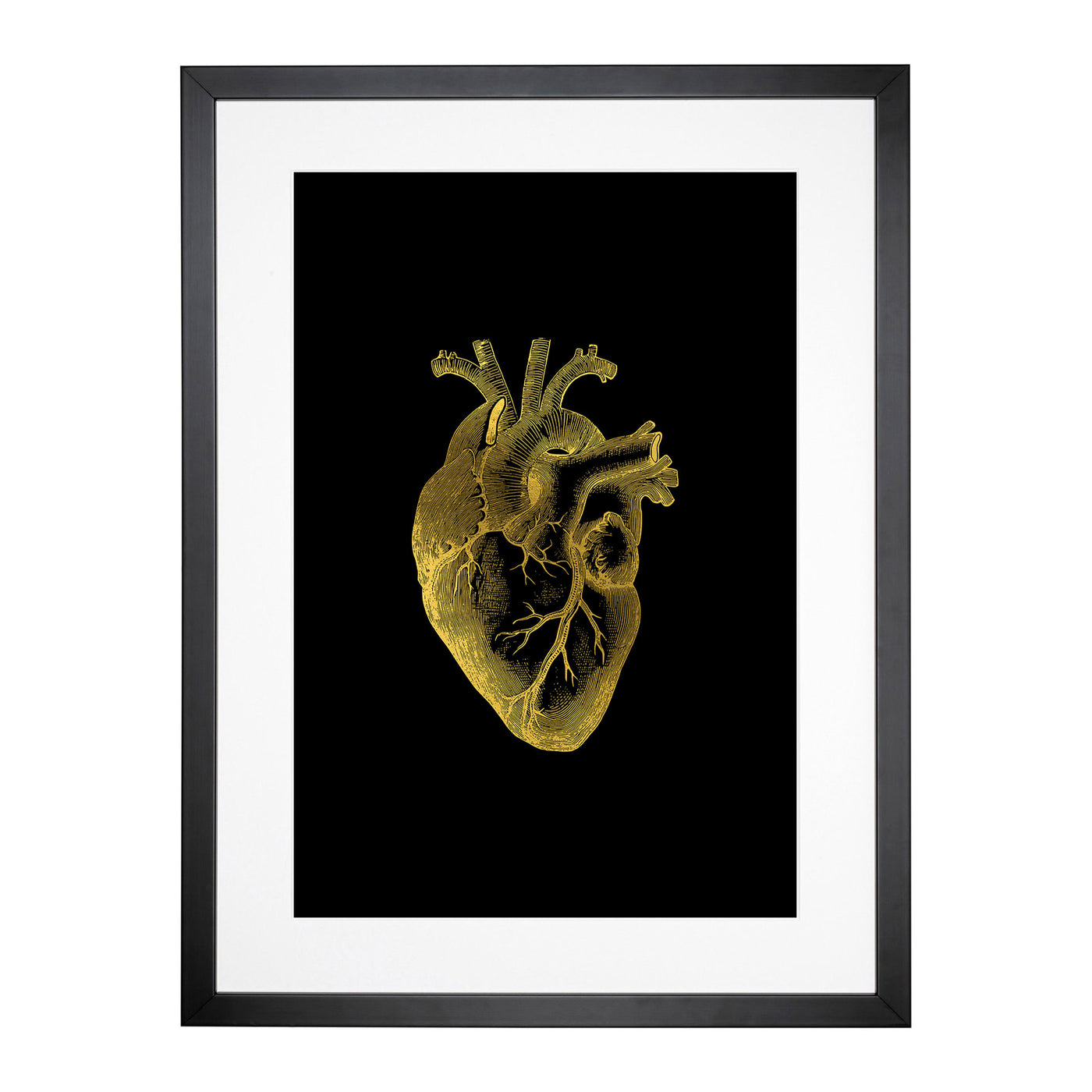 Black Gold Anatomical Heart Framed Print Main Image